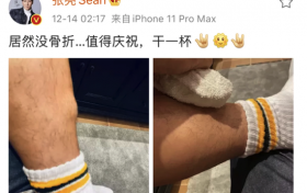 张亮怼恶评晒骨折 喊话网友说话要“积德”